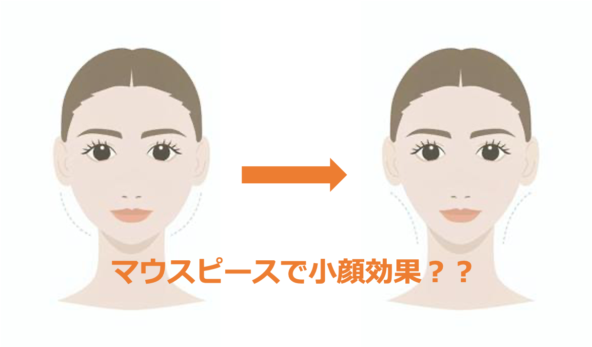 歯ぎしりマウスピースで顔痩せする噂の真相｜エラ張り解消と小顔効果