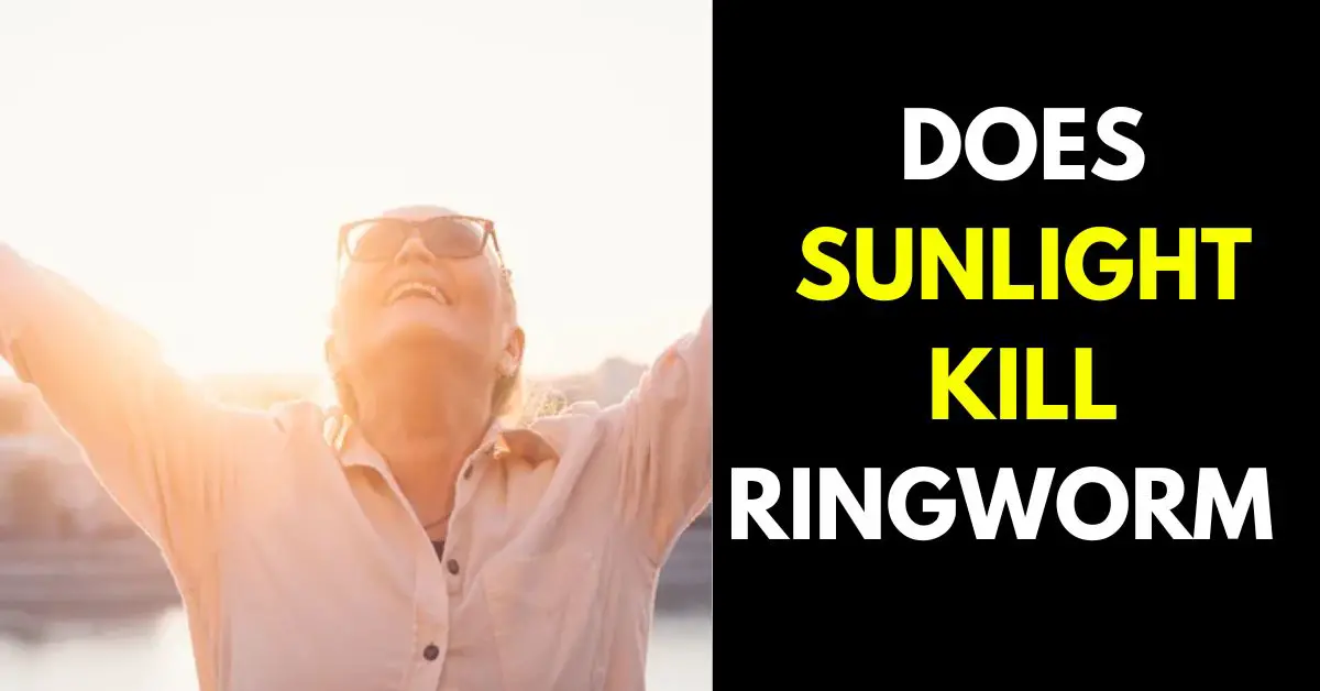 Does Sun Help Ringworm