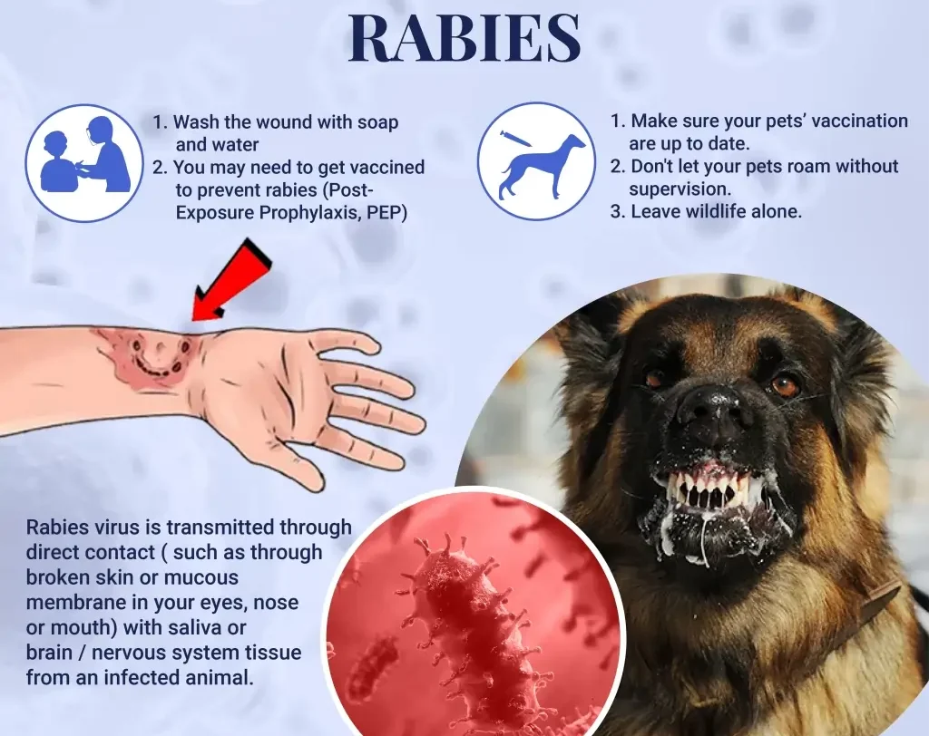 Can Humans Get Rabies