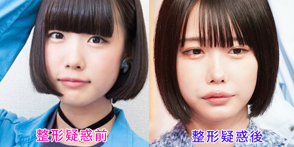 あのちゃんの「整形前」噂を徹底検証——地下アイドル時代から2026年の現在に至るビジュアル変遷とセルフプロデュースの真実