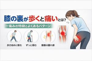 【画像あり】 膝の裏 歩くと痛い 知恵袋 衝撃の最新ニュース #680