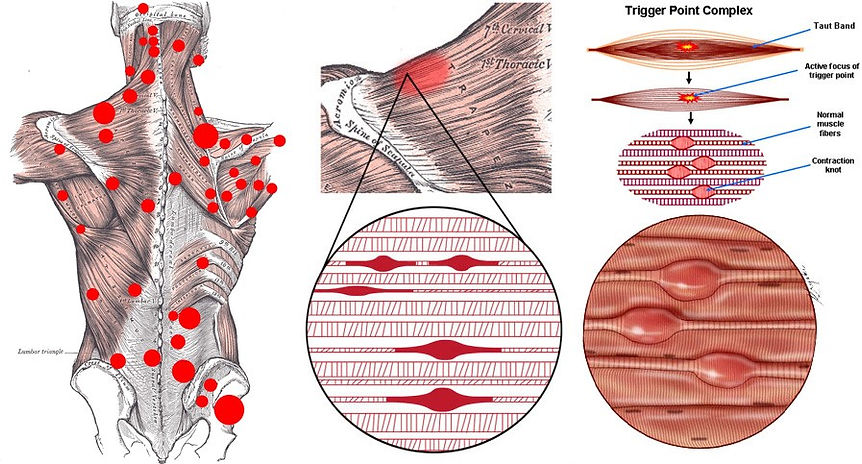 What Channel Is Trigger Point On