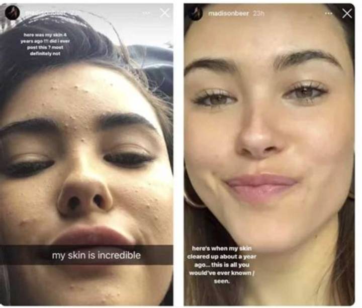 Madison Beer No Makeup: What People Mean, What’s Real, What to Know